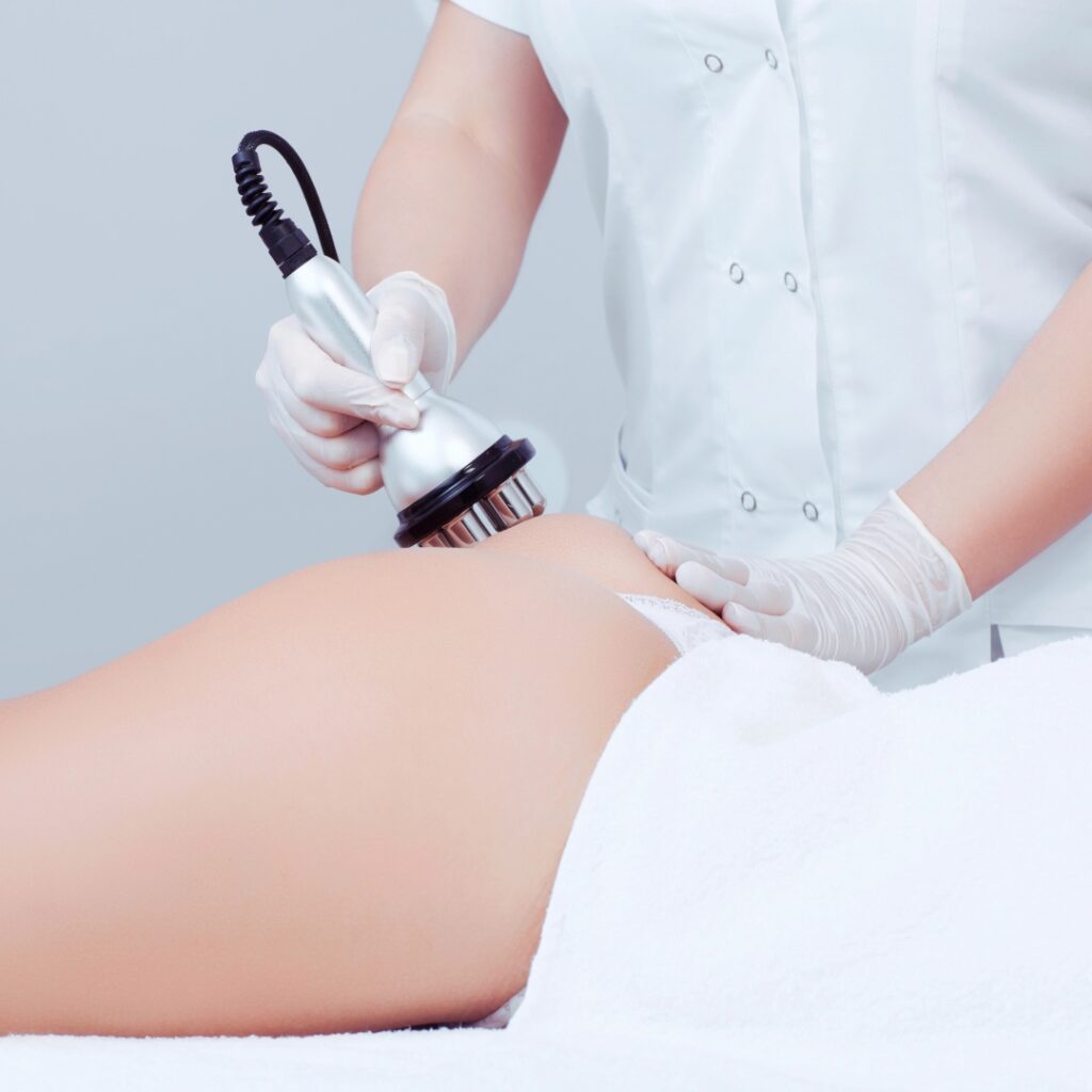 RADIOFREQUENCY BODY ANTI-AGING TREATMENTS